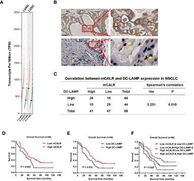 CALR-TLR4 Complex Inhibits Non-Small Cell <mark class="highlighted">Lung Cancer Progression</mark> by Regulating the Migration and Maturation of Dendritic Cells